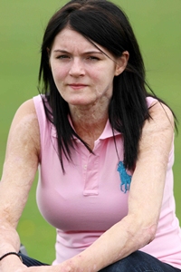 Vicky Chaundy
